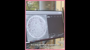 What do you like about ELISpot?  #antibodies #science #biotech #elispot #lifescience