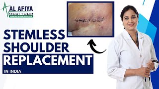 STEMLESS SHOULDER REPLACEMENT