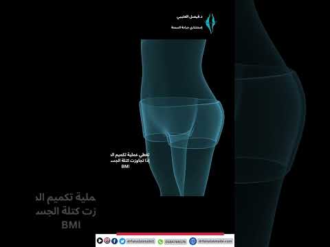 التأمين الصحي لمرضى السمنة