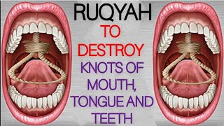 POWERFUL RUQYAH TO DESTROY JINN AND KNOTS OF MOUTH, TONGUE, TEETH . by Al Quran 166,135 views 1 year ago 17 minutes