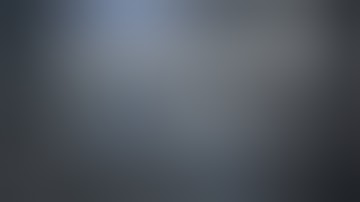 Eroded Incus. Total Ossicular Chain Reconstructio. Malleus Relocation & Silastic Banding Technique