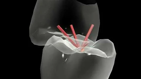 DYNAMIC OCCLUSION - MANDIBLE