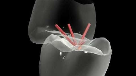 DYNAMIC OCCLUSION - MANDIBLE