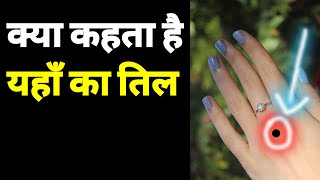 हाथ के पीछे तिल होने का मतलब | Mole On Back Of Hand