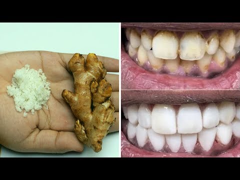 মাত্র ২ মিনিটে মুক্তোর মতো সাদা দাঁত পান IIGet white teeth like pearls in just 2 minutes