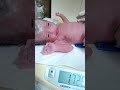 Newborn weight, After birth IUGR BABY 💞🙇#shortsfeed #viral