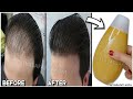 Homemade herbal hair shampoo,🌿 it accelerate hair growth and treat baldness in one week