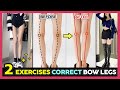 🔥ONLY 2 EXERCISES TO FIX BOW LEGS &amp; O Shaped Legs | Make your legs straighter fast and easy