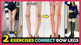 🔥ONLY 2 EXERCISES TO FIX BOW LEGS &amp; O Shaped Legs | Make your legs straighter fast and easy