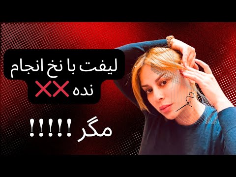 لیفت با نخ لیفت شقیقه و ابرو تجربه ای نو