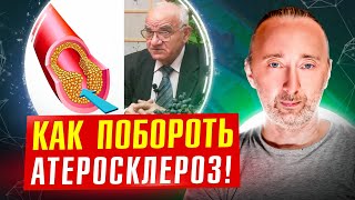 Профессор Исаев: Как Не Допустить Атеросклероз И Избавиться От Него На 100%?