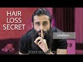 This Is Why You Are Losing Your Hair | Bearded Chokra