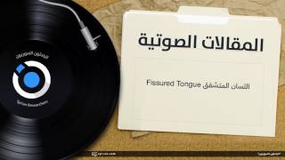 اللسان المتشقق Fissured Tongue