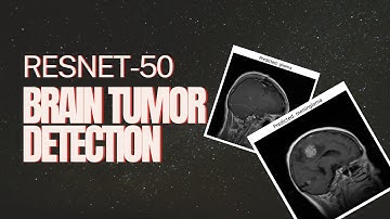 Brain Tumor Detection with ResNet-50 | CNN Project Demo