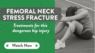 Femoral neck stress fracture: Treatments for this dangerous hip injury