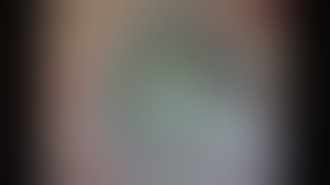 Subluxated cataract PCR Glued IOL Scaffold Soosan Jacob 5 min