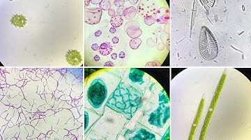 Microscopic Slides of Algae (Live and Prepared)