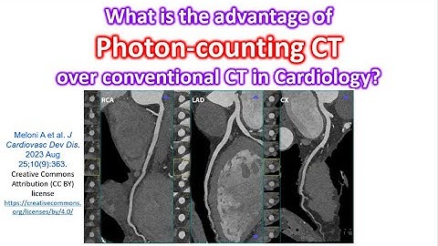What is the advantage of Photon-counting CT over conventional CT in cardiology?