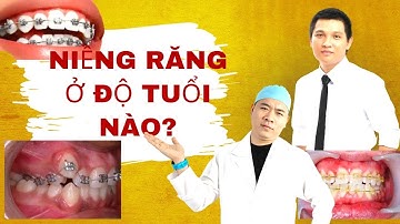 Độ tuổi niềng răng tốt nhất | Điều cần biết khi niềng răng I Nha Khoa Smile HT