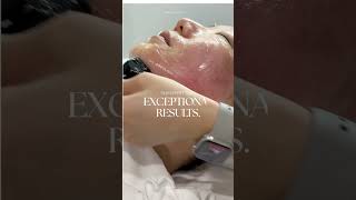 Inmode Minifx Fat Reduction & Forma Collagen Regeneration Treatment