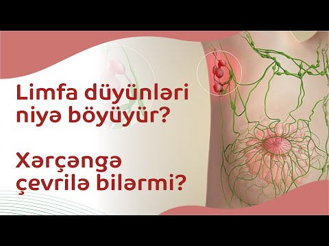 Video: Periaortik limfa düyünləri haradadır?