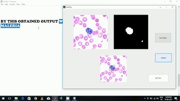 Malaria Detection using Cells -Matlab Project