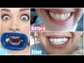 My Professional Teeth Whitening Experience! BEFORE & AFTER