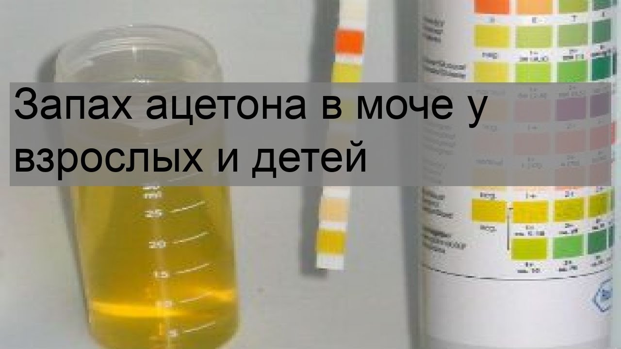 У мочи есть запах. Ацетон в моче. Моча пахнет ацетоном. Запах ацетона в моче. Ацетон в моче у ребенка.