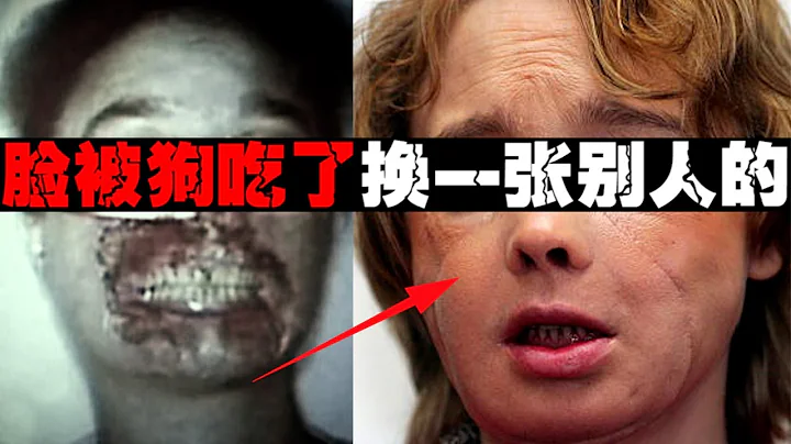 【換臉悲劇】換了一張別人的臉，生活開始倒計時【鄭鄭得證】 - 天天要聞
