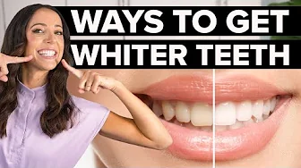 3 Easy Tips for Better Teeth Whitening Results