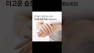 간지럽고 갈라지는 피부의 원인은 습진?! #shorts