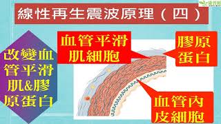 20170628 wolf 新科技新型體外震波男性幸福和酸痛症皆有效能再生神經和血管 康普頓診所陳盈州醫師
