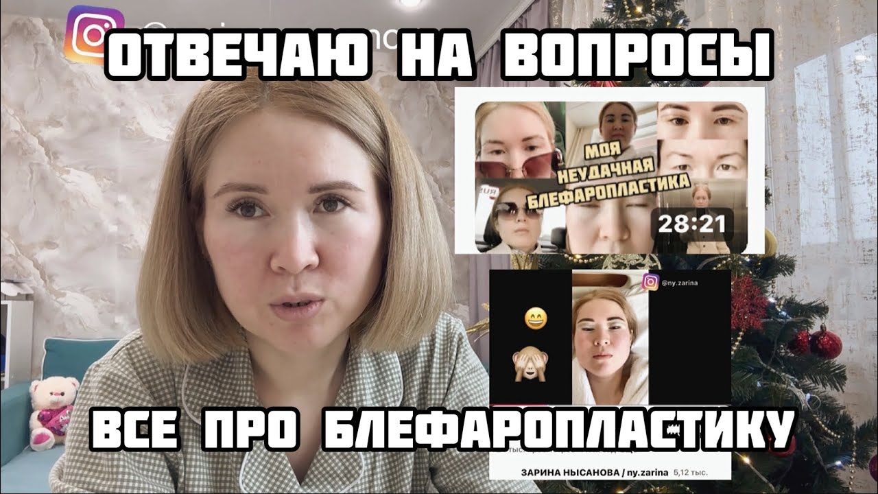 Вопросы и ответы про мою блефаропластику/  вспоминаю что было / блефаропластика азиатских век