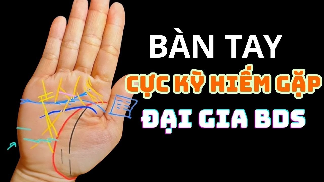 Sinh Ra Với Bàn Tay Phúc Tướng – Có Cần Làm Gì Không Hay Cứ Ngồi Đợi May Mắn