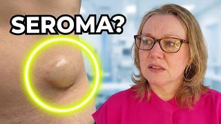 Fluid Pocket After Surgery? (The Truth About Seromas)