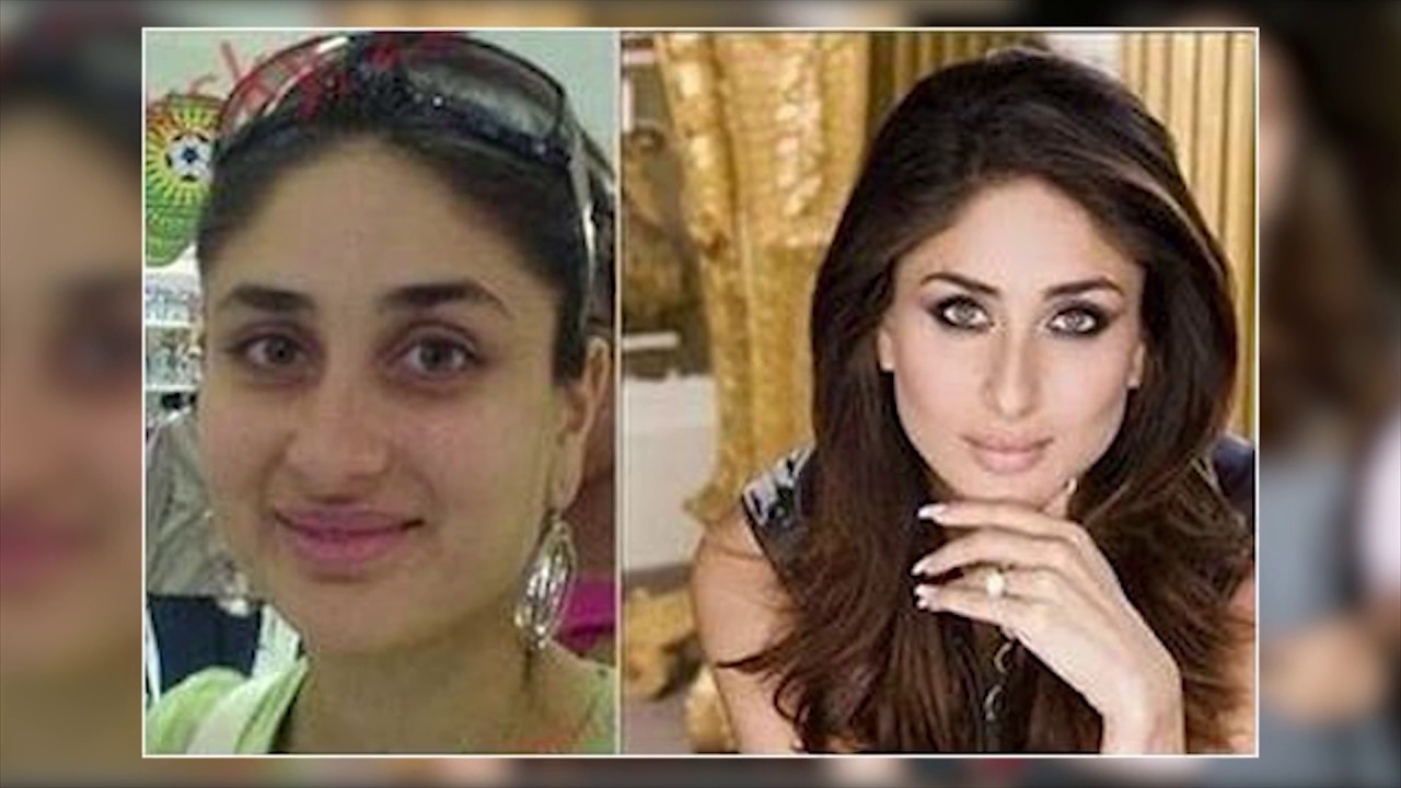 Kareena kapoor before and after surgery