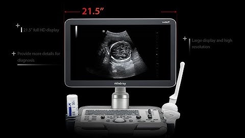 Dormed Hellas - Mindray DC-30 Full-HD