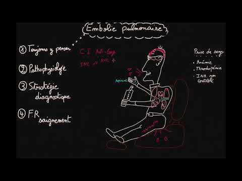 Embolie pulmonaire - Prise en charge - Partie 2 - Docteur Synapse