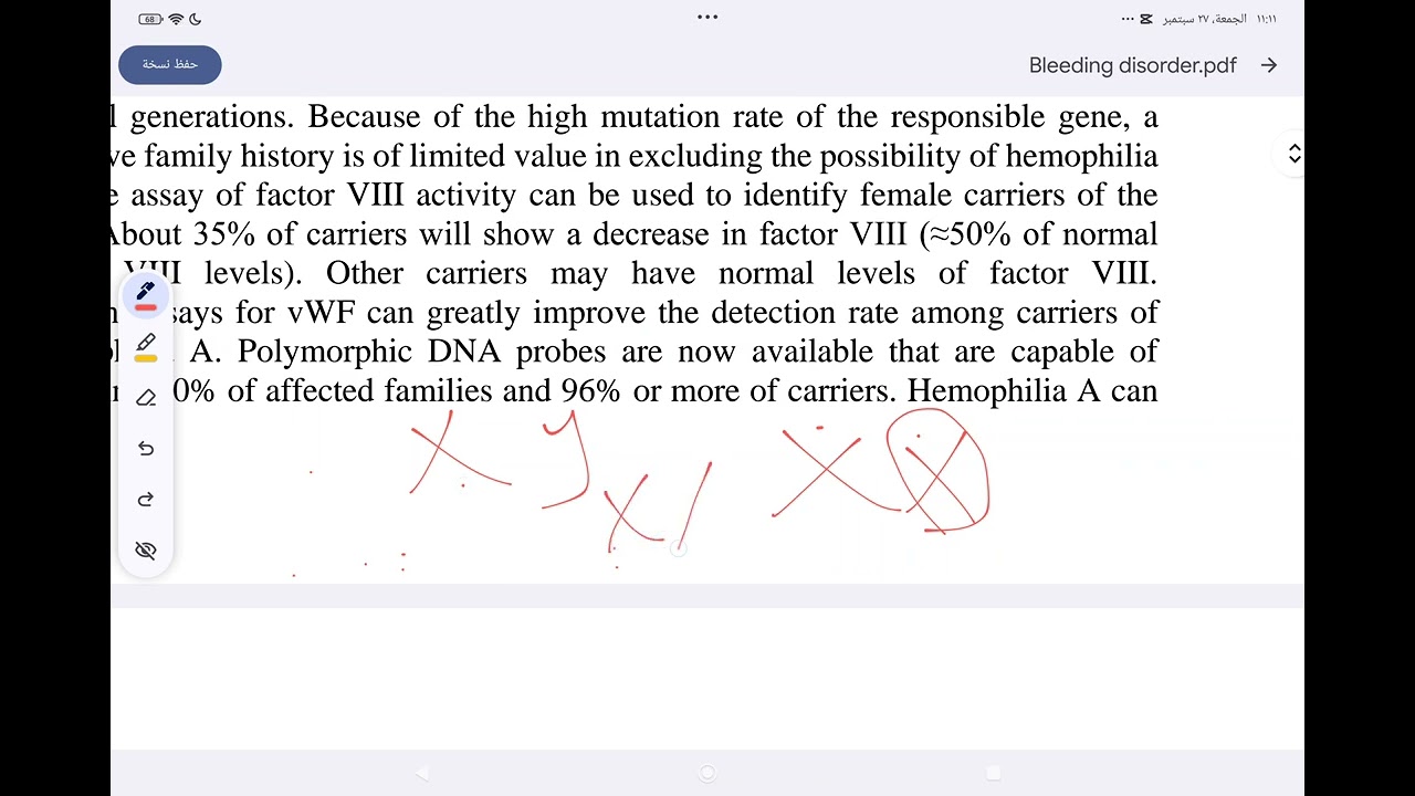 oral surgery bleeding disorder part(1) مرحلة رابعة طب اسنان