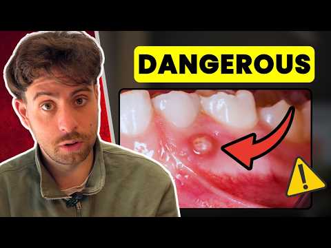 Here’s When a Tooth ABSCESS Becomes Dangerous