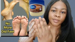 Mix This With Vaseline No More Hand or Feet Wrinkles - Works Like Magic