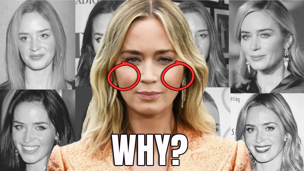 The Reason Behind Emily Blunt S Huge Face Change Plastic Surgery