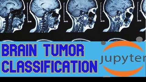 Brain Tumor Classification Using Convolution Neural Network with Augmentation