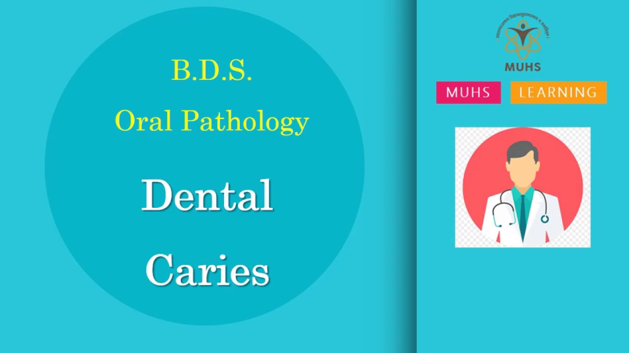 Dental Caries Oral Pathology BDS 00801 PPT Only Dental Clinic