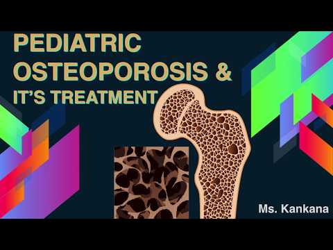 What are Paediatric Osteoporosis and it’s Treatment Options | Biotechnology | General Medicine