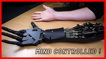 Mind controlled Bionic Hand