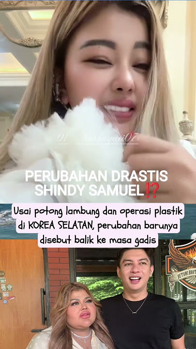Perubahan drastis shindy samuel