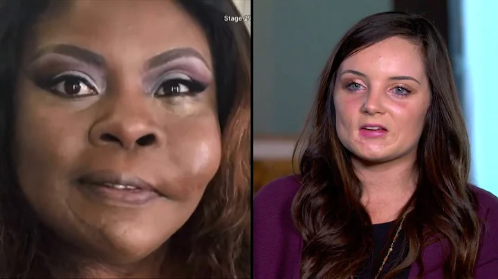 Face Transplants & Reconstructive Procedures That ...