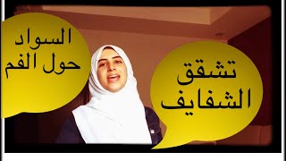 تشقق الشفايف