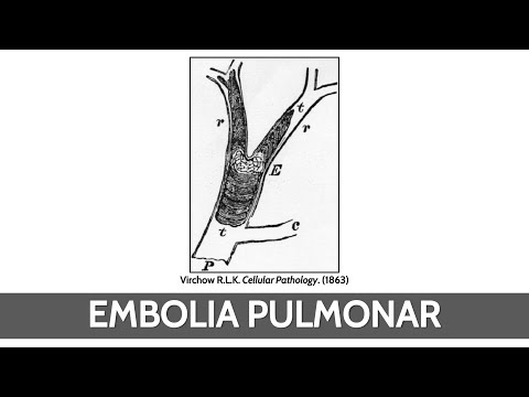 Trombosis Venosa + Embolia Pulmonar